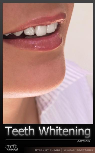 修牙(Teeth&nbsp;Whitening)--PS动作