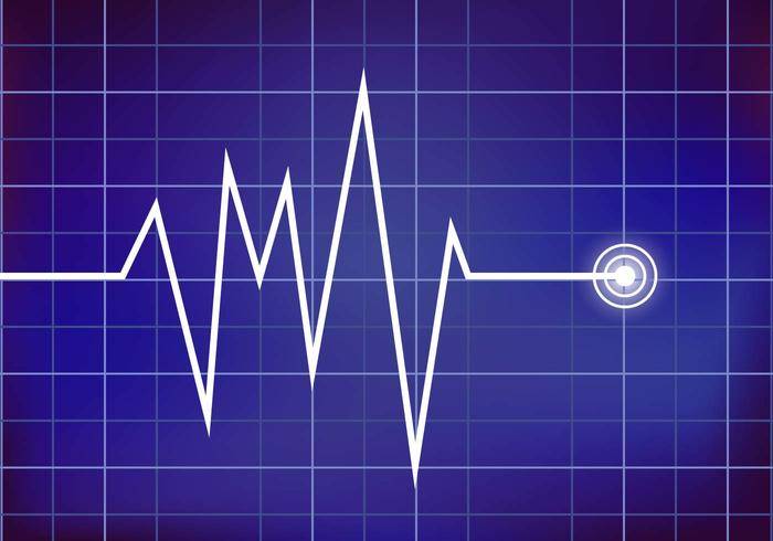 心脏监测矢量Ekg